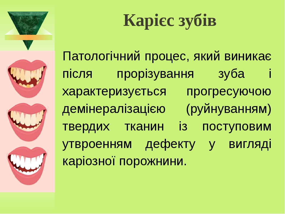 Презентація "КАРІЄС У ШКОЛЯРІВ"
