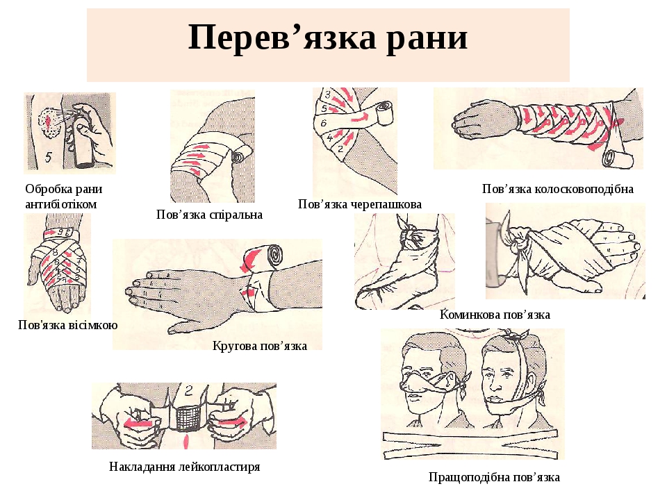 Перев з. Перев'язки за м/п.