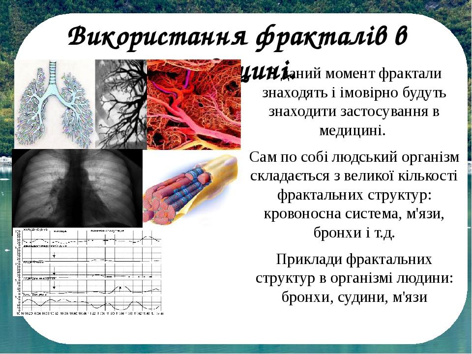 Використання фракталів в медицині. В даний момент фрактали знаходять і імовірно будуть знаходити застосування в медицині. Сам по собі людський орга...