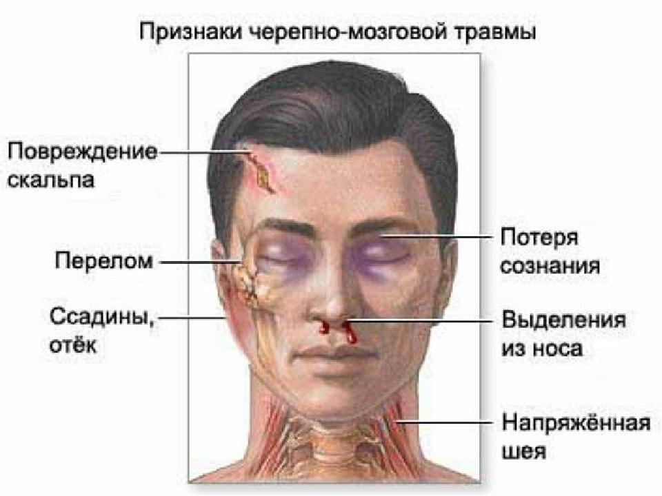 Денервация головки фото