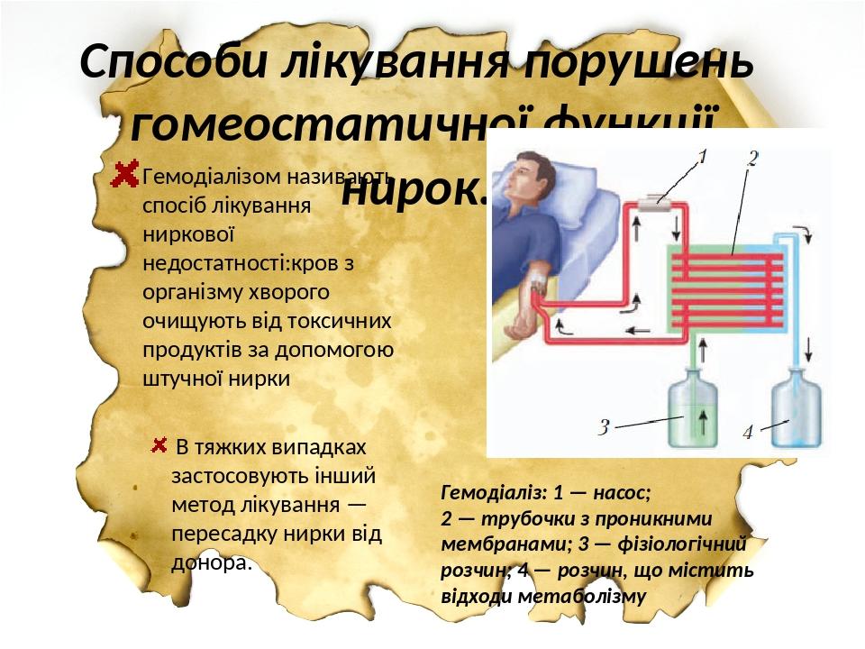 Способи лікування порушень гомеостатичної функції нирок. Гемодіалізом називають спосіб лікування ниркової недостатності:кров з організму хворого оч...