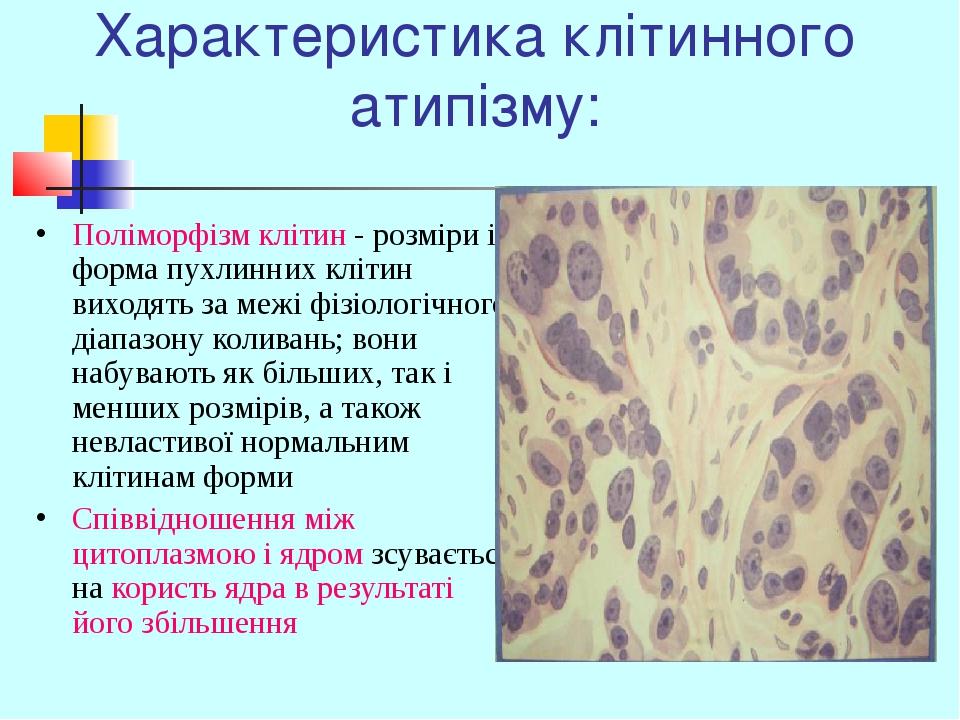 Характеристика клітинного атипізму: Поліморфізм клітин - розміри і форма пухлинних клітин виходять за межі фізіологічного діапазону коливань; вони ...