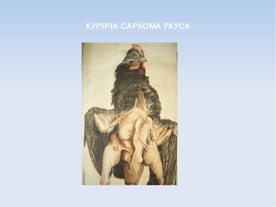 КУРЯЧА САРКОМА РАУСА