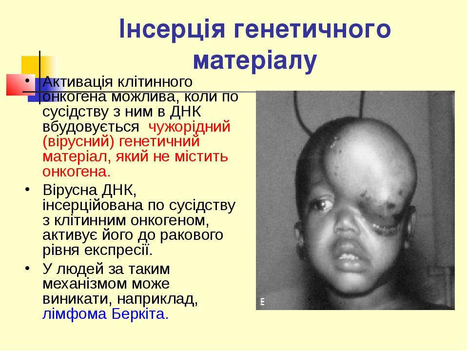 Інсерція генетичного матеріалу Активація клітинного онкогена можлива, коли по сусідству з ним в ДНК вбудовується чужорідний (вірусний) генетичний м...
