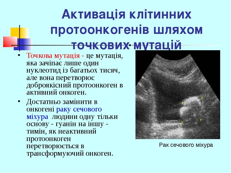 Активація клітинних протоонкогенів шляхом точкових мутацій Точкова мутація - це мутація, яка зачіпає лише один нуклеотид із багатьох тисяч, але вон...