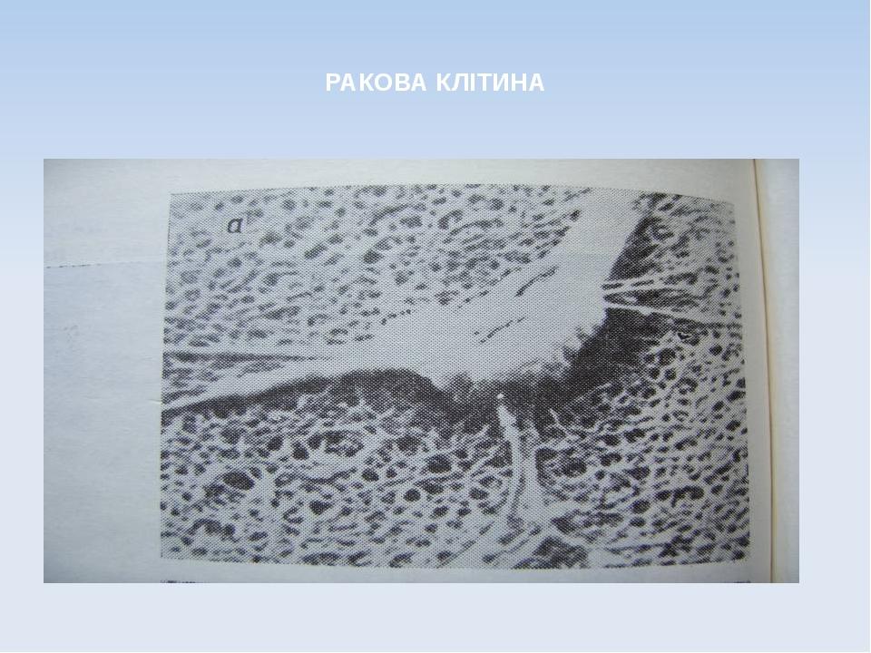 РАКОВА КЛІТИНА