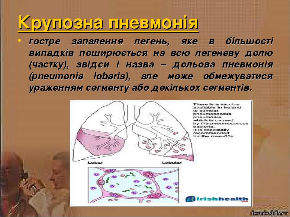 Мокрота при пневмонии фото