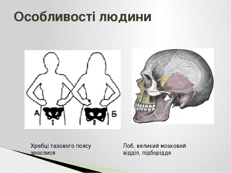Особливості людини Хребці тазового поясу зрослися Лоб, великий мозковий відділ, підборіддя