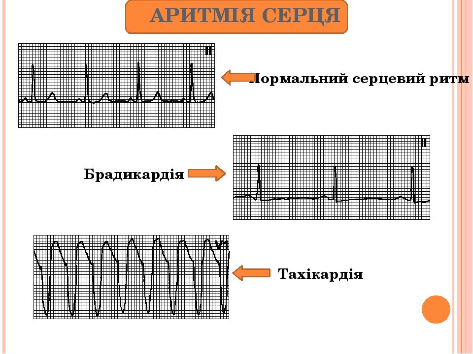 " Серце і судини"