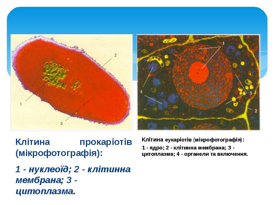 Клітина прокаріотів (мікрофотографія): 1 - нуклеоїд; 2 - клітинна мембрана; 3 - цитоплазма. Клітина еукаріотів (мікрофотографія): 1 - ядро; 2 - клі...