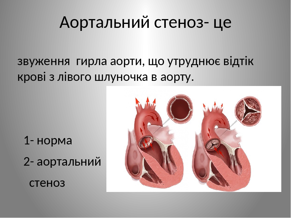 Где находится аорта у человека фото у мужчин