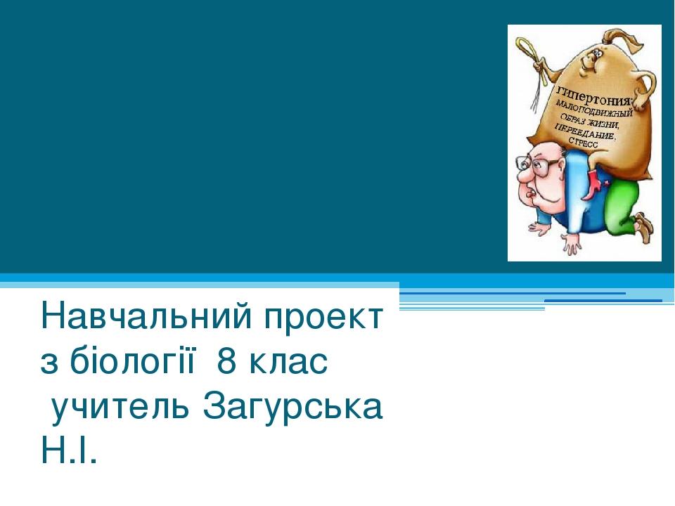 Гіподинамія - ворог сучасної людини Навчальний проект з біології 8 клас учитель Загурська Н.І.