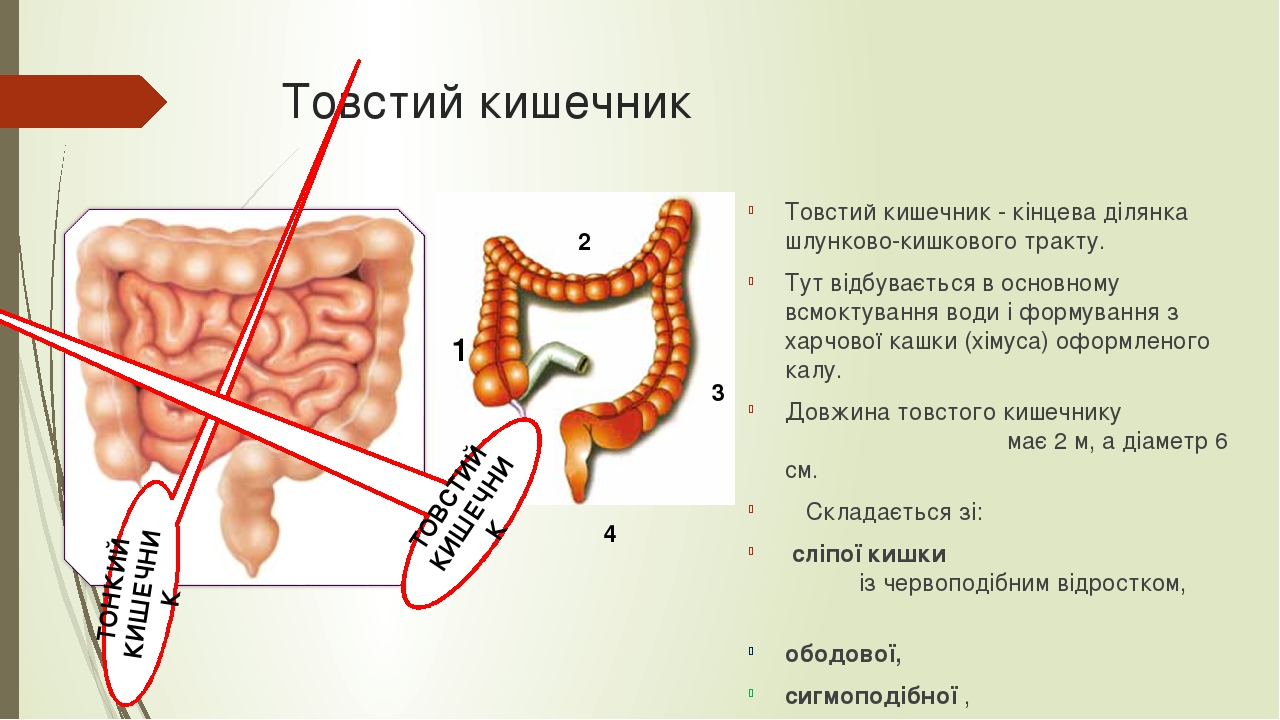 Баугиниевая заслонка где находится в кишечнике картинки