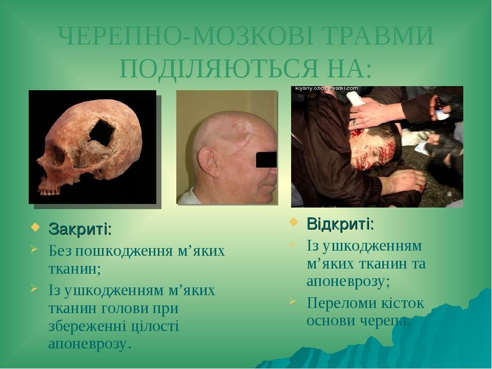 ЧЕРЕПНО-МОЗКОВІ ТРАВМИ ПОДІЛЯЮТЬСЯ НА: Закриті: Без пошкодження м’яких тканин; Із ушкодженням м’яких тканин голови при збереженні цілості апоневроз...