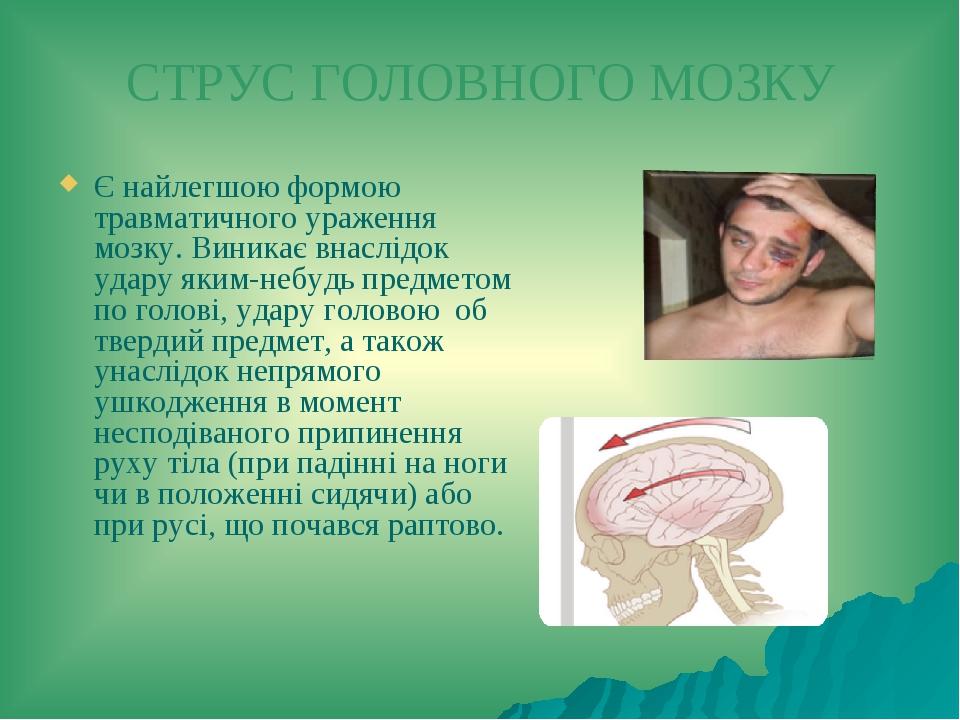 СТРУС ГОЛОВНОГО МОЗКУ Є найлегшою формою травматичного ураження мозку. Виникає внаслідок удару яким-небудь предметом по голові, удару головою об тв...