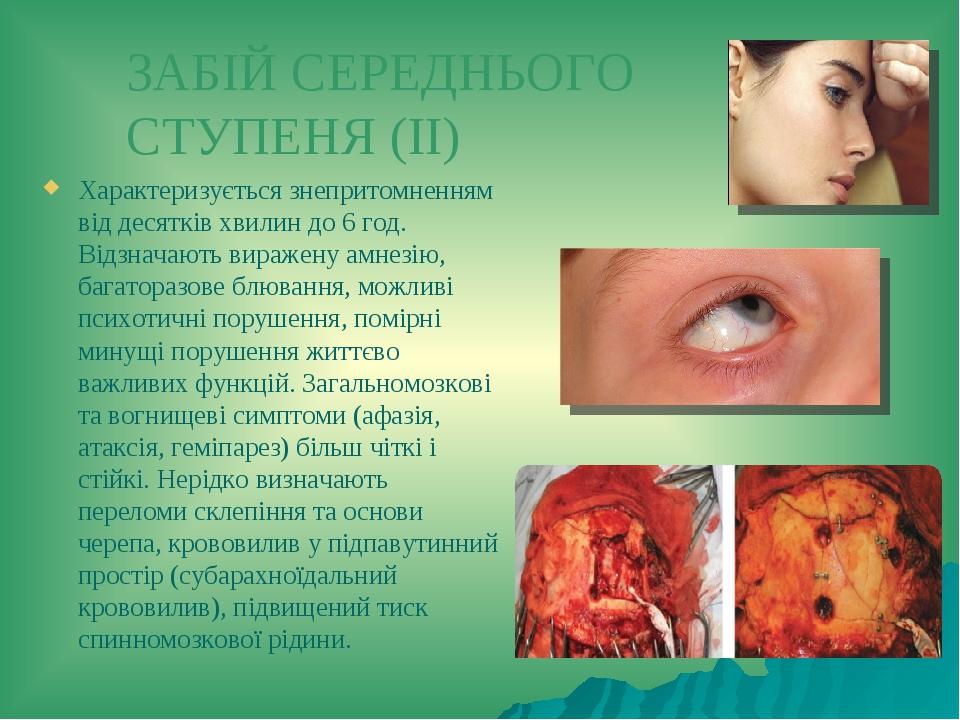 ЗАБІЙ СЕРЕДНЬОГО СТУПЕНЯ (ІІ) Характеризується знепритомненням від десятків хвилин до 6 год. Відзначають виражену амнезію, багаторазове блювання, м...