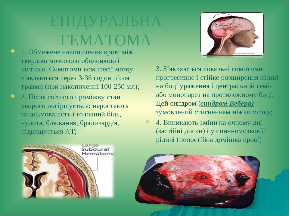 ЕПІДУРАЛЬНА ГЕМАТОМА 1. Обмежене накопичення крові між твердою мозковою оболонкою і кісткою. Симптоми компресії мозку з’являються через 3-36 годин ...