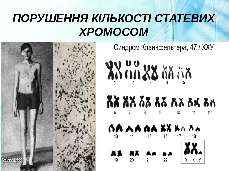 ПОРУШЕННЯ КІЛЬКОСТІ СТАТЕВИХ ХРОМОСОМ