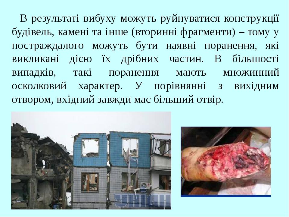 В результаті вибуху можуть руйнуватися конструкції будівель, камені та інше (вторинні фрагменти) – тому у постраждалого можуть бути наявні пораненн...