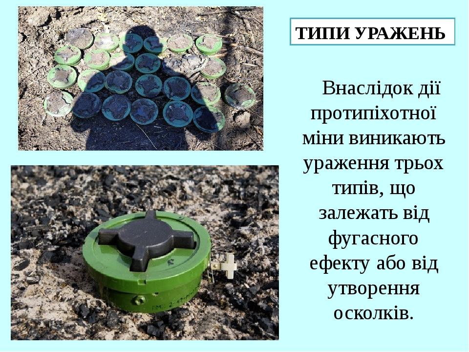 Внаслідок дії протипіхотної міни виникають ураження трьох типів, що залежать від фугасного ефекту або від утворення осколків. ТИПИ УРАЖЕНЬ