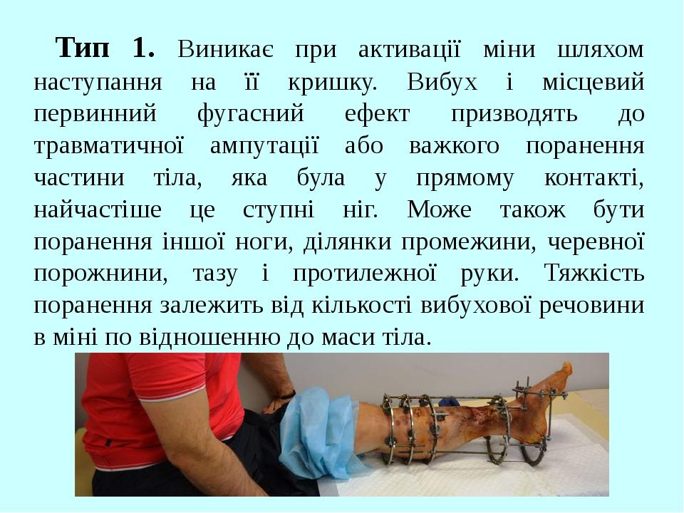Тип 1. Виникає при активації міни шляхом наступання на її кришку. Вибух і місцевий первинний фугасний ефект призводять до травматичної ампутації аб...