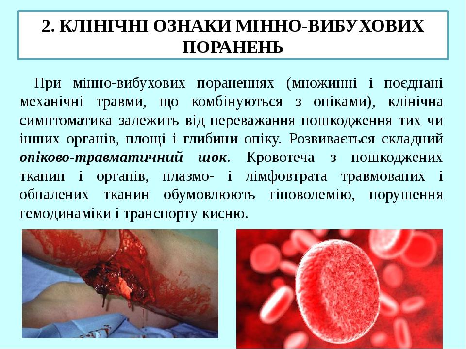 2. КЛІНІЧНІ ОЗНАКИ МІННО-ВИБУХОВИХ ПОРАНЕНЬ При мінно-вибухових пораненнях (множинні і поєднані механічні травми, що комбінуються з опіками), кліні...