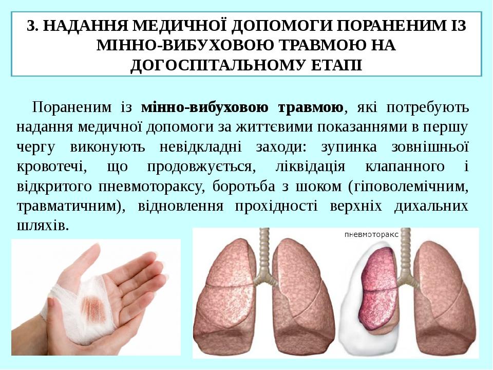 3. НАДАННЯ МЕДИЧНОЇ ДОПОМОГИ ПОРАНЕНИМ ІЗ МІННО-ВИБУХОВОЮ ТРАВМОЮ НА ДОГОСПІТАЛЬНОМУ ЕТАПІ Пораненим із мінно-вибуховою травмою, які потребують над...