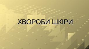 Презентація "Хвороби шкіри (дерматози)"