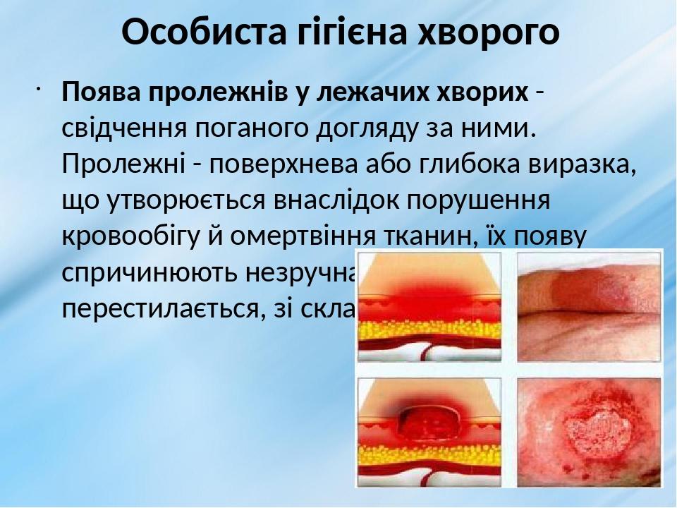 Особиста гігієна хворого Поява пролежнів у лежачих хворих - свідчення поганого догляду за ними. Пролежні - поверхнева або глибока виразка, що утвор...