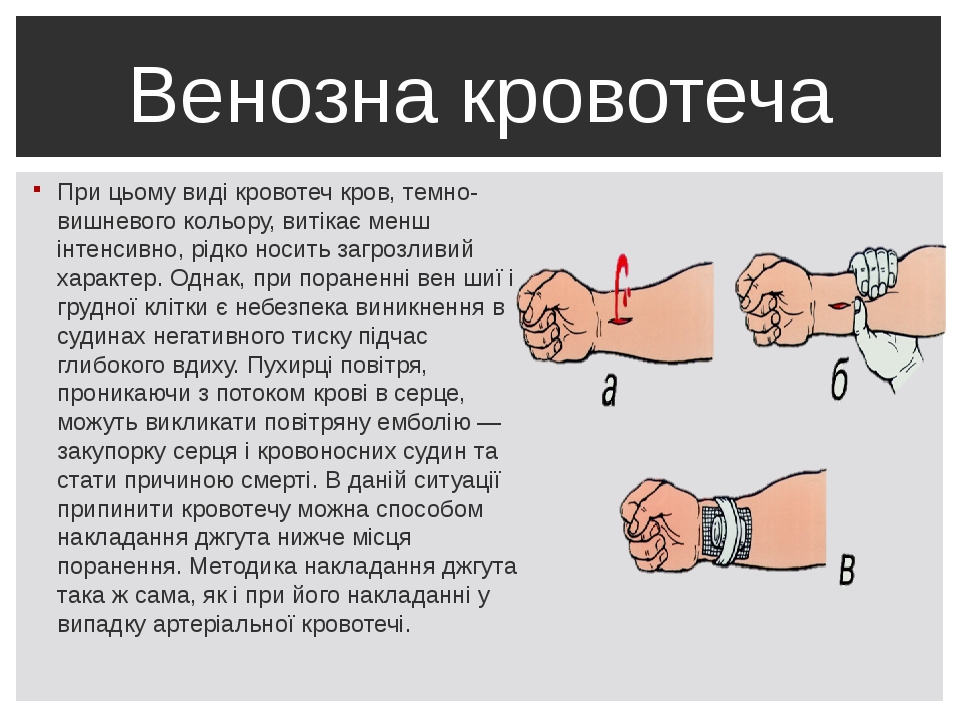 Кровотечение на фоне приема фемостона