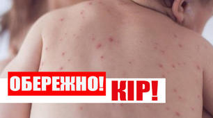 Кір-одна з основних причин смерті серед дітей раннього віку в усьому світі.