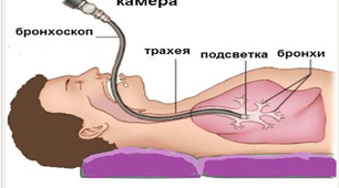 Бронхоскопія. Відеоматеріали