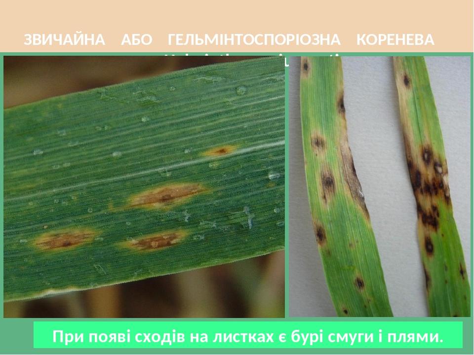 ЗВИЧАЙНА АБО ГЕЛЬМІНТОСПОРІОЗНА КОРЕНЕВА ГНИЛЬ - Helminthosporium sativum При появі сходів на листках є бурі смуги і плями.