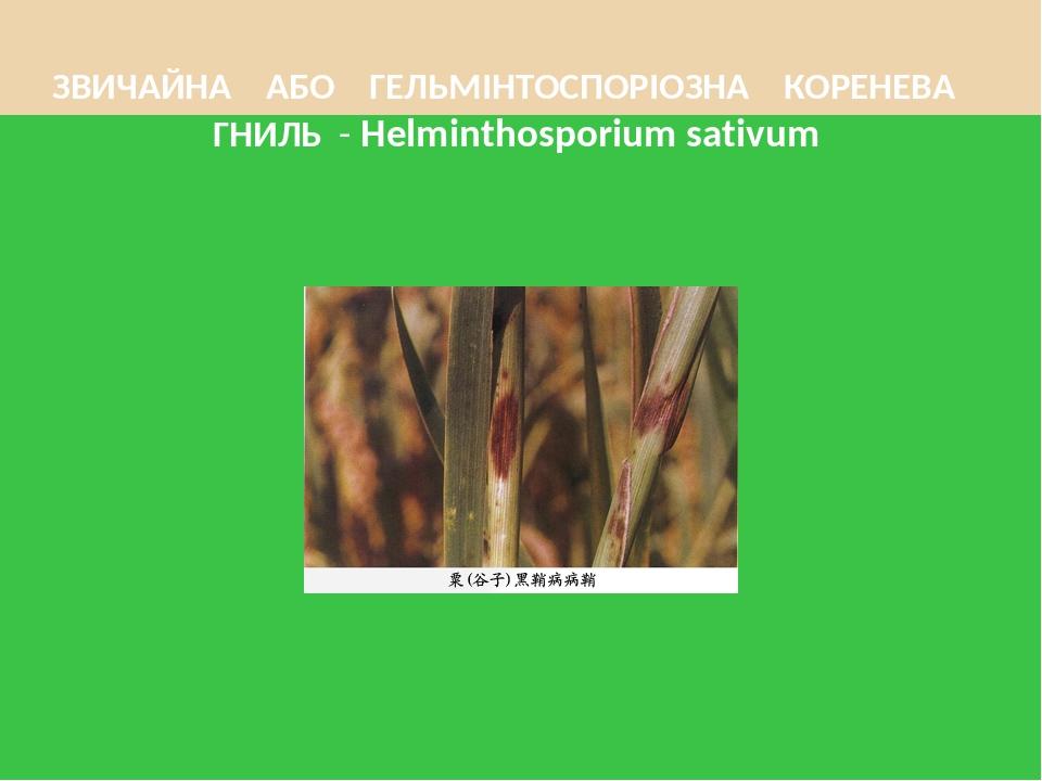ЗВИЧАЙНА АБО ГЕЛЬМІНТОСПОРІОЗНА КОРЕНЕВА ГНИЛЬ - Helminthosporium sativum