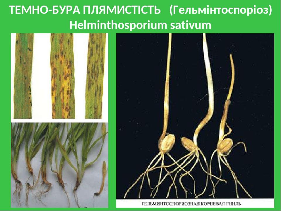 ТЕМНО-БУРА ПЛЯМИСТІСТЬ (Гельмінтоспоріоз) Helminthosporium sativum