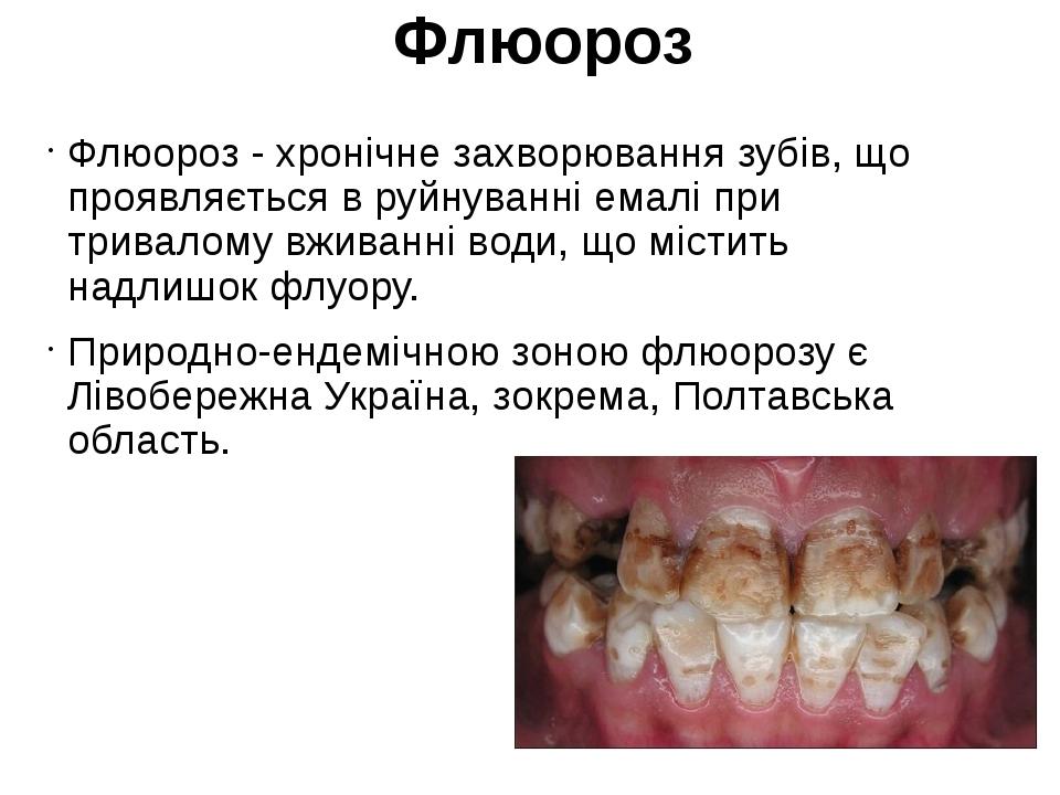 Муаровый рисунок эмали при флюорозе обусловлен