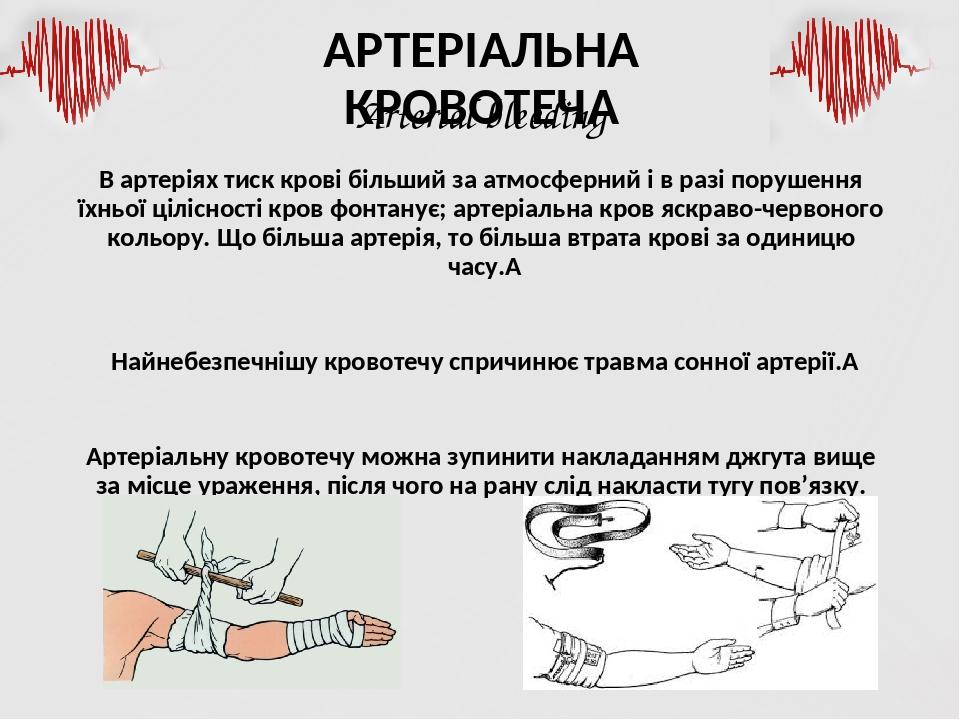 "Кровотечі та рани" - презентація, Захист Вітчизни 10 клас ...